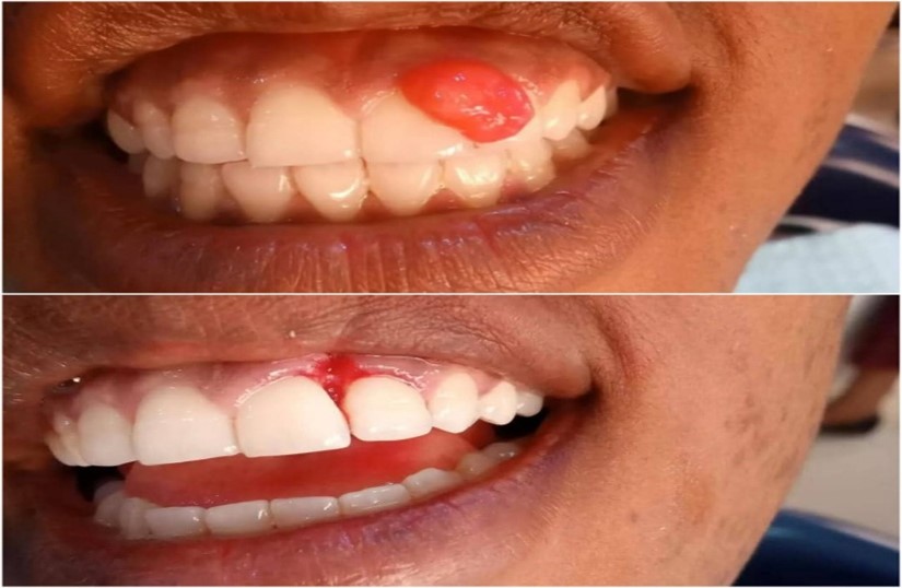 Oral Surgery
