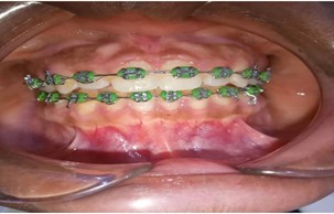 Orthodontics