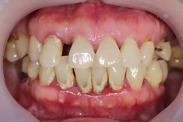 Periodontics